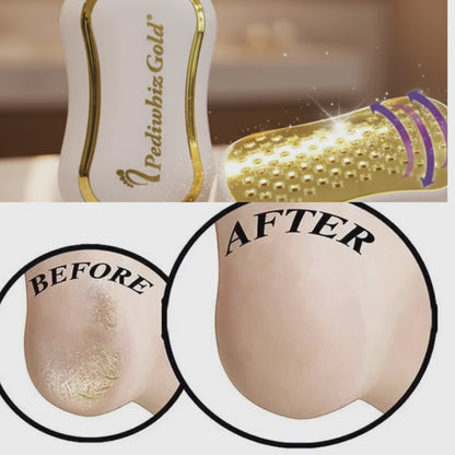 Máquina de depilar + una Lima para pies